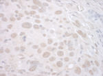 CTNNBL1 Antibody in Immunohistochemistry (IHC)