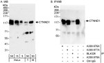 CTNND1 Antibody in Western Blot (WB)