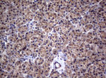 CTNND1 Antibody in Immunohistochemistry (Paraffin) (IHC (P))