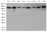 CTNND1 Antibody in Western Blot (WB)