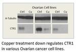 CTR1/SLC31A1 Antibody in Western Blot (WB)