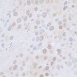 CTR9 Antibody in Immunohistochemistry (IHC)