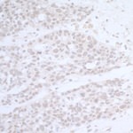 CTR9 Antibody in Immunohistochemistry (IHC)