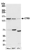 CTR9 Antibody in Western Blot (WB)