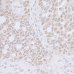 CTR9 Antibody in Immunohistochemistry (IHC)