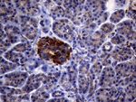 CTSL1 Antibody in Immunohistochemistry (Paraffin) (IHC (P))