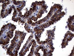 CTSL1 Antibody in Immunohistochemistry (Paraffin) (IHC (P))