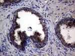 CTSL1 Antibody in Immunohistochemistry (Paraffin) (IHC (P))