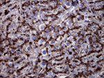 CTSL1 Antibody in Immunohistochemistry (Paraffin) (IHC (P))