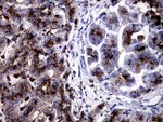 CTSL1 Antibody in Immunohistochemistry (Paraffin) (IHC (P))