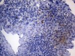 CTSL1 Antibody in Immunohistochemistry (Paraffin) (IHC (P))