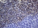 CTSL1 Antibody in Immunohistochemistry (Paraffin) (IHC (P))