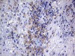 CTSL1 Antibody in Immunohistochemistry (Paraffin) (IHC (P))