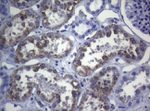 CTSL1 Antibody in Immunohistochemistry (Paraffin) (IHC (P))