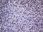 CTSL1 Antibody in Immunohistochemistry (Paraffin) (IHC (P))