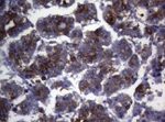 CTSL1 Antibody in Immunohistochemistry (Paraffin) (IHC (P))