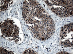 CTSL1 Antibody in Immunohistochemistry (Paraffin) (IHC (P))