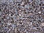 CTSL1 Antibody in Immunohistochemistry (Paraffin) (IHC (P))