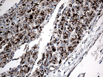 CTSL1 Antibody in Immunohistochemistry (Paraffin) (IHC (P))