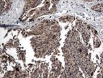 CTSL1 Antibody in Immunohistochemistry (Paraffin) (IHC (P))