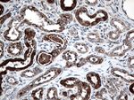 CTSL1 Antibody in Immunohistochemistry (Paraffin) (IHC (P))