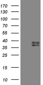 CTSL1 Antibody in Western Blot (WB)