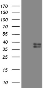 CTSL1 Antibody in Western Blot (WB)