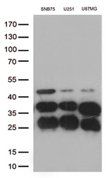 CTSL1 Antibody in Western Blot (WB)