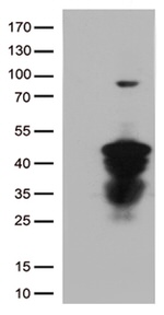 CTSL1 Antibody in Western Blot (WB)