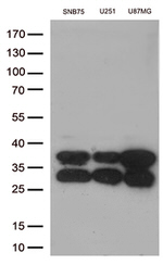 CTSL1 Antibody in Western Blot (WB)