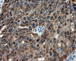 CUGBP1 Antibody in Immunohistochemistry (Paraffin) (IHC (P))