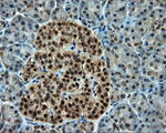 CUGBP1 Antibody in Immunohistochemistry (Paraffin) (IHC (P))