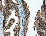 CUGBP1 Antibody in Immunohistochemistry (Paraffin) (IHC (P))