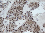 CUL4B Antibody in Immunohistochemistry (Paraffin) (IHC (P))