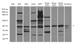 CUX1/Protein CASP Antibody in Western Blot (WB)