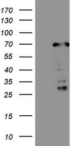 CWC27 Antibody in Western Blot (WB)