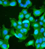 CXCR1 Antibody in Immunocytochemistry (ICC/IF)