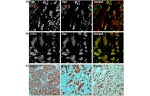 CXCR4 Antibody in Immunohistochemistry (IHC)