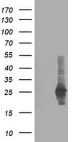 CXorf26 Antibody in Western Blot (WB)