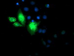 CYB5R3 Antibody in Immunocytochemistry (ICC/IF)