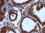 CYB5R3 Antibody in Immunohistochemistry (Paraffin) (IHC (P))