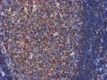 CYB5R3 Antibody in Immunohistochemistry (Paraffin) (IHC (P))