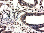 CYB5R3 Antibody in Immunohistochemistry (Paraffin) (IHC (P))