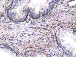 CYB5R3 Antibody in Immunohistochemistry (Paraffin) (IHC (P))