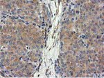 CYB5R3 Antibody in Immunohistochemistry (Paraffin) (IHC (P))