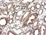 CYB5R3 Antibody in Immunohistochemistry (Paraffin) (IHC (P))