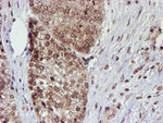 CYP17A1 Antibody in Immunohistochemistry (Paraffin) (IHC (P))