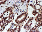 CYP17A1 Antibody in Immunohistochemistry (Paraffin) (IHC (P))