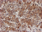 CYP17A1 Antibody in Immunohistochemistry (Paraffin) (IHC (P))