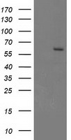 CYP17A1 Antibody in Western Blot (WB)